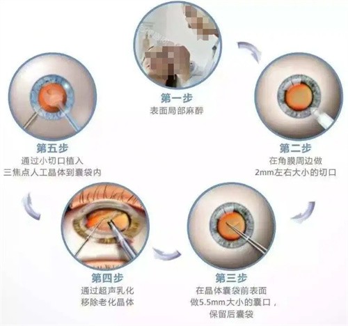 昆明眼科干貨：2026年紅十字會醫院醫師排班表+線上掛號教程，預約指南來了！